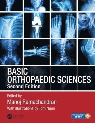 bokomslag Basic Orthopaedic Sciences