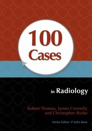 Robert Thomas, James Connelly, Christopher Burke - 100 Cases in Radiology, Häftad