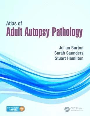 bokomslag Atlas of Adult Autopsy Pathology