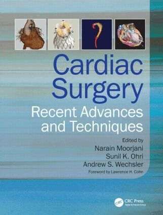 Narain Moorjani, Sunil K Ohri, Andrew Wechsler - Cardiac Surgery, Inbunden