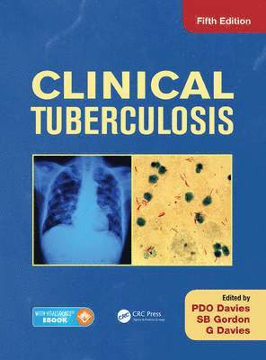 bokomslag Clinical Tuberculosis