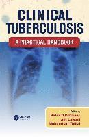Clinical Tuberculosis: A Practical Handbook