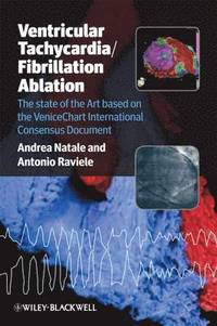 bokomslag Ventricular Tachycardia / Fibrillation Ablation