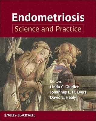 bokomslag Endometriosis