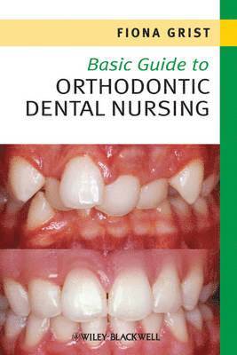 bokomslag Basic Guide to Orthodontic Dental Nursing