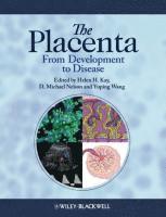 bokomslag The Placenta
