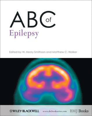 bokomslag ABC of Epilepsy