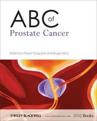 bokomslag ABC of Prostate Cancer