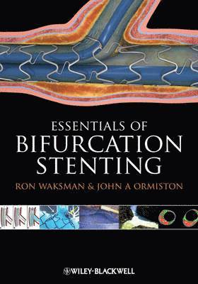 Ron Waksman, John A. Ormiston - Bifurcation Stenting, Inbunden