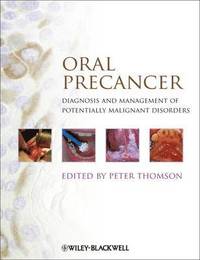 bokomslag Oral Precancer