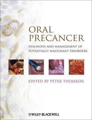 bokomslag Oral Precancer