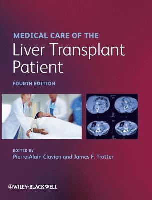bokomslag Medical Care of the Liver Transplant Patient