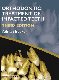 bokomslag Orthodontic Treatment of Impacted Teeth