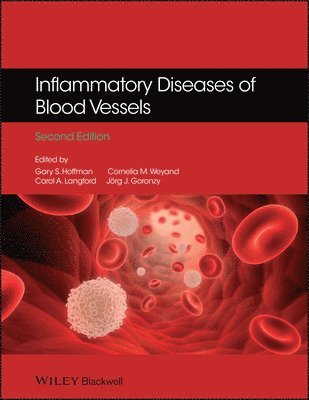 bokomslag Inflammatory Diseases of Blood Vessels