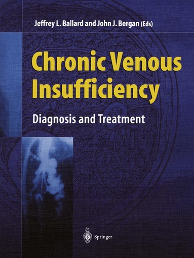 Jeffrey L. Ballard, John Bergan - Chronic Venous Insufficiency, Häftad
