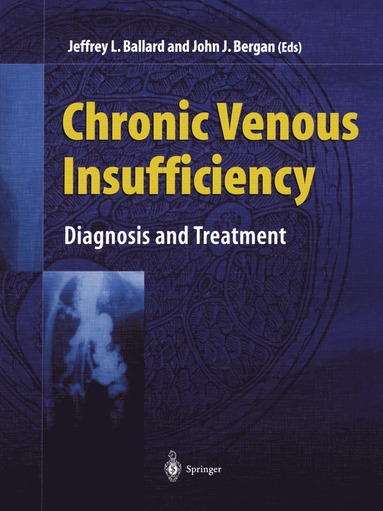 bokomslag Chronic Venous Insufficiency