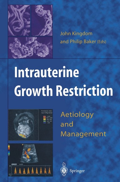 John Kingdom, Philip Baker - Intrauterine Growth Restriction, Häftad