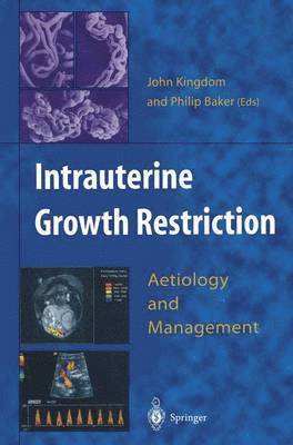 Intrauterine Growth Restriction 1