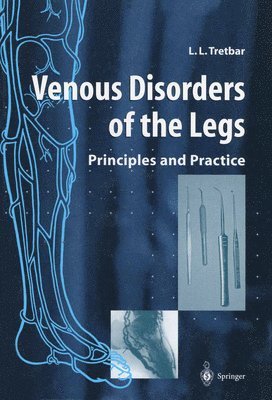 bokomslag Venous Disorders of the Legs