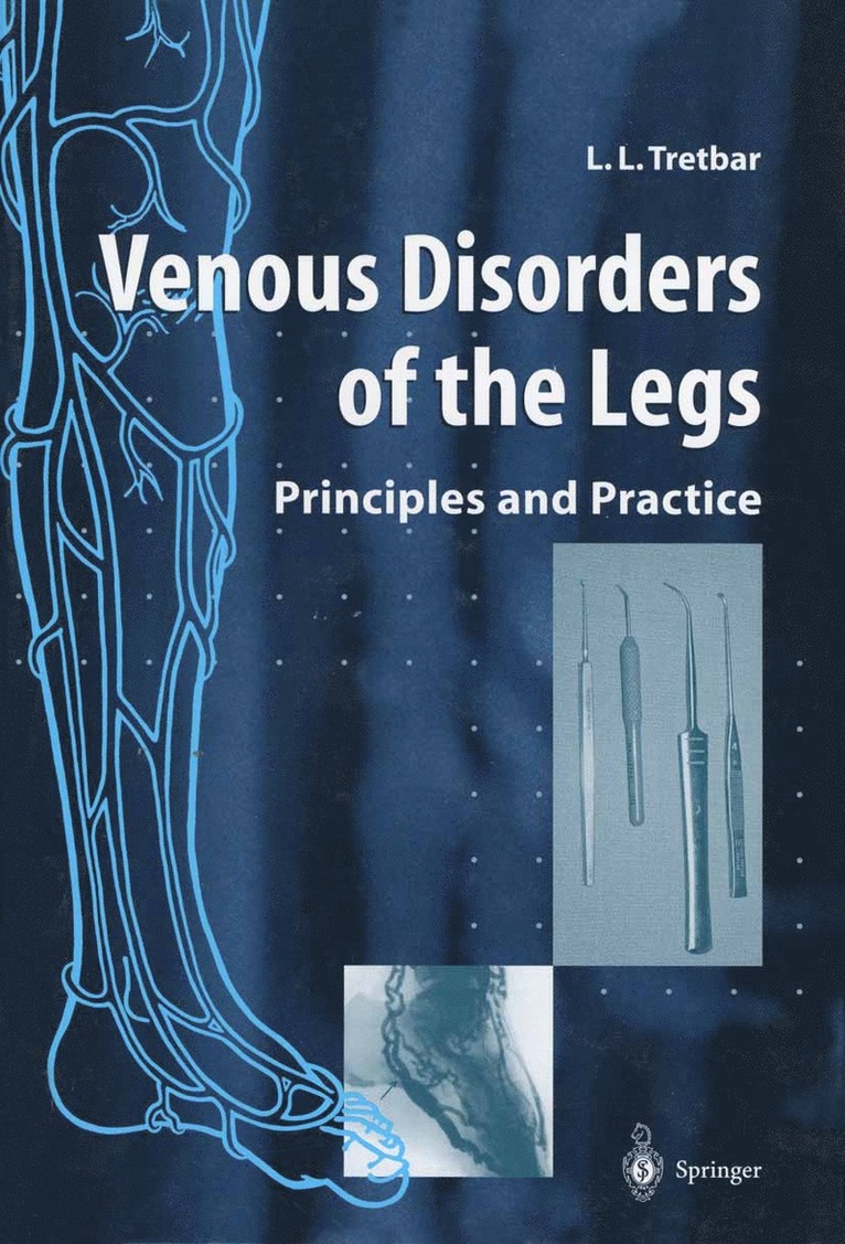 Lawrence L. Tretbar - Venous Disorders of the Legs, Häftad