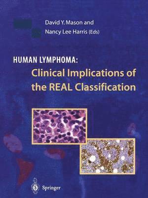 Human Lymphoma: Clinical Implications of the REAL Classification 1