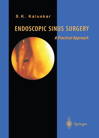 bokomslag Endoscopic Sinus Surgery