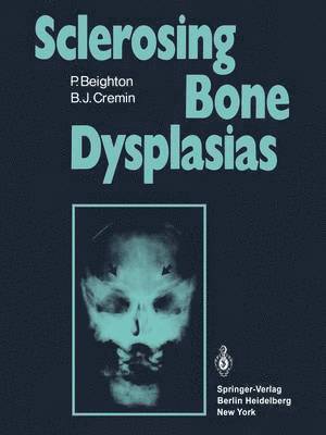Sclerosing Bone Dysplasias 1