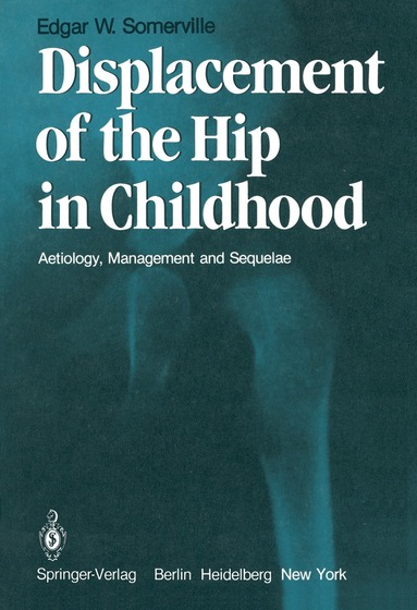 bokomslag Displacement of the Hip in Childhood