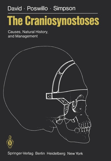 David J. David, D. Poswillo, D. Simpson - Craniosynostoses, Häftad
