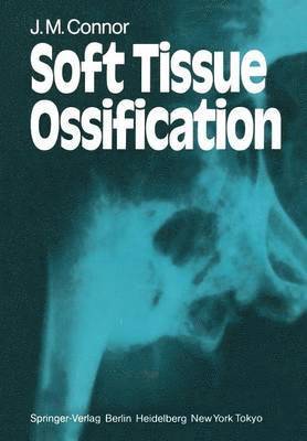 Soft Tissue Ossification 1