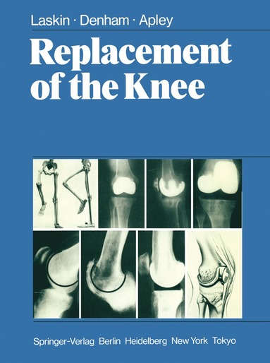 bokomslag Replacement of the Knee