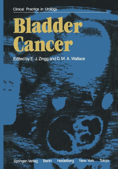 bokomslag Bladder Cancer