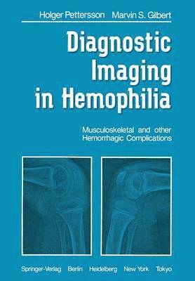 H. Pettersson, M.S. Gilbert, M. S. Gilbert - Diagnostic Imaging in Hemophilia, Häftad