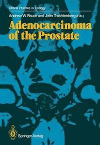 bokomslag Adenocarcinoma of the Prostate