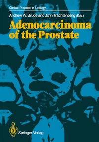 bokomslag Adenocarcinoma of the Prostate