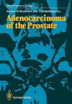 Adenocarcinoma of the Prostate 1