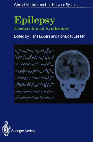 Hans Lüders, Ronald P. Lesser - Epilepsy, Häftad