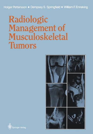 bokomslag Radiologic Management of Musculoskeletal Tumors