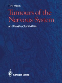 bokomslag Tumours of the Nervous System