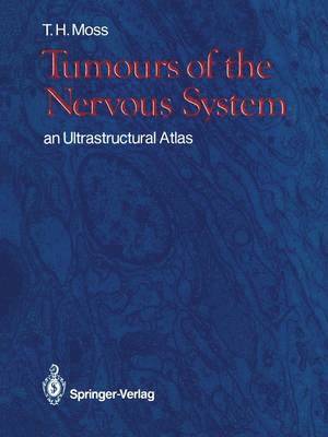 Timothy H. Moss - Tumours of the Nervous System, Häftad