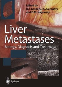 bokomslag Liver Metastases