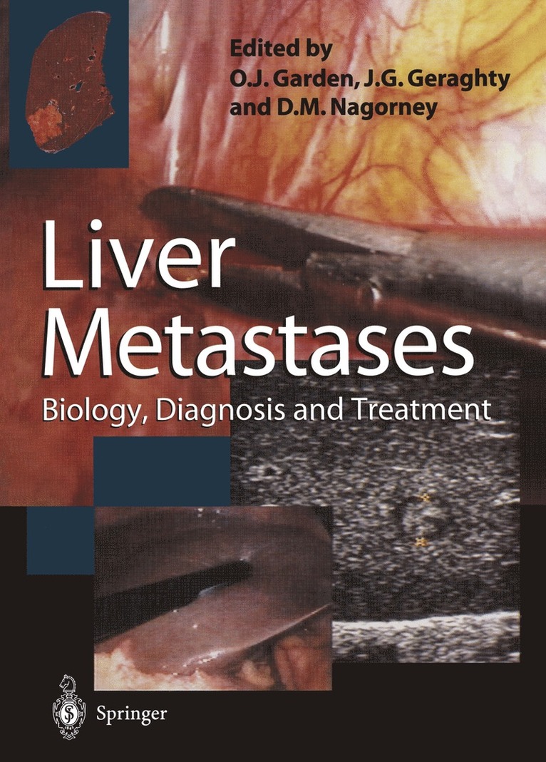 O. James Garden, James G. Geraghty, David M. Nagorney - Liver Metastases, Häftad