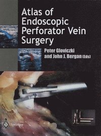 bokomslag Atlas of Endoscopic Perforator Vein Surgery
