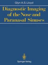 bokomslag Diagnostic Imaging of the Nose and Paranasal Sinuses
