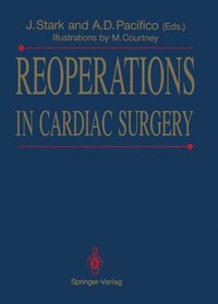 bokomslag Reoperations in Cardiac Surgery