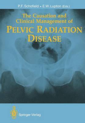 bokomslag The Causation and Clinical Management of Pelvic Radiation Disease