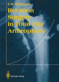 bokomslag Revision Surgery in Total Hip Arthroplasty
