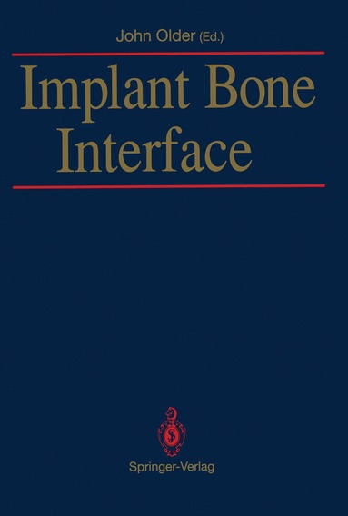 bokomslag Implant Bone Interface