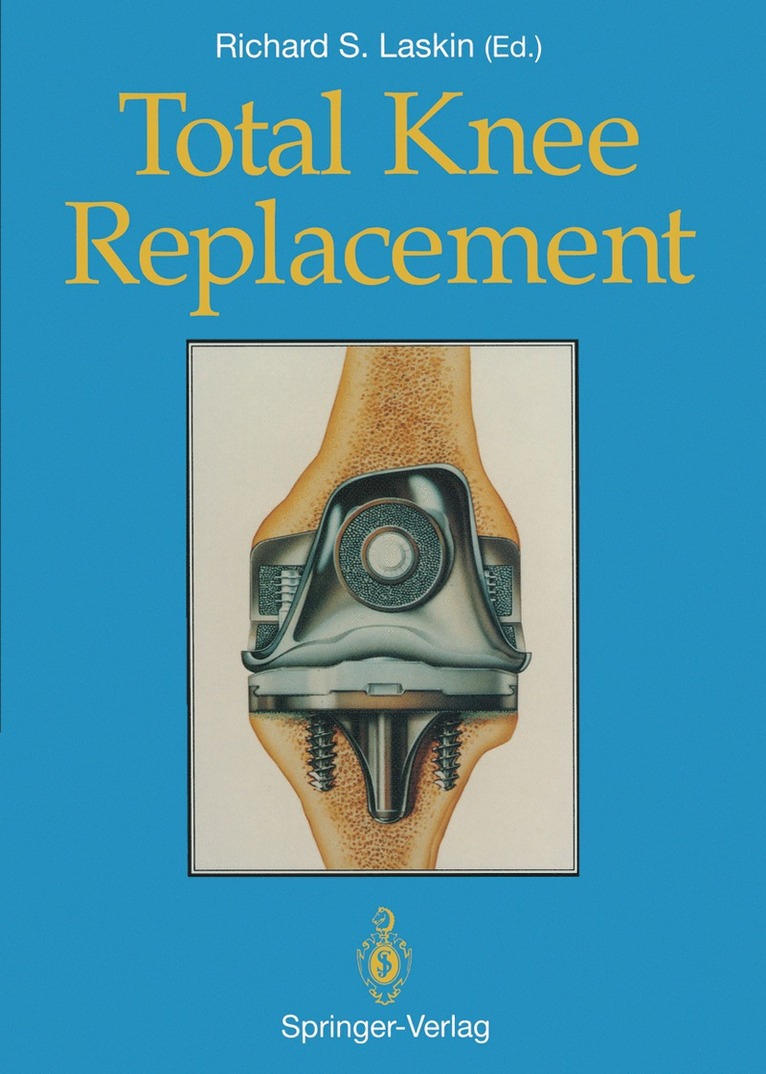 Richard S. Laskin - Total Knee Replacement, Häftad