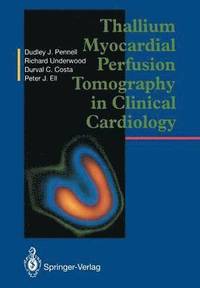 bokomslag Thallium Myocardial Perfusion Tomography in Clinical Cardiology